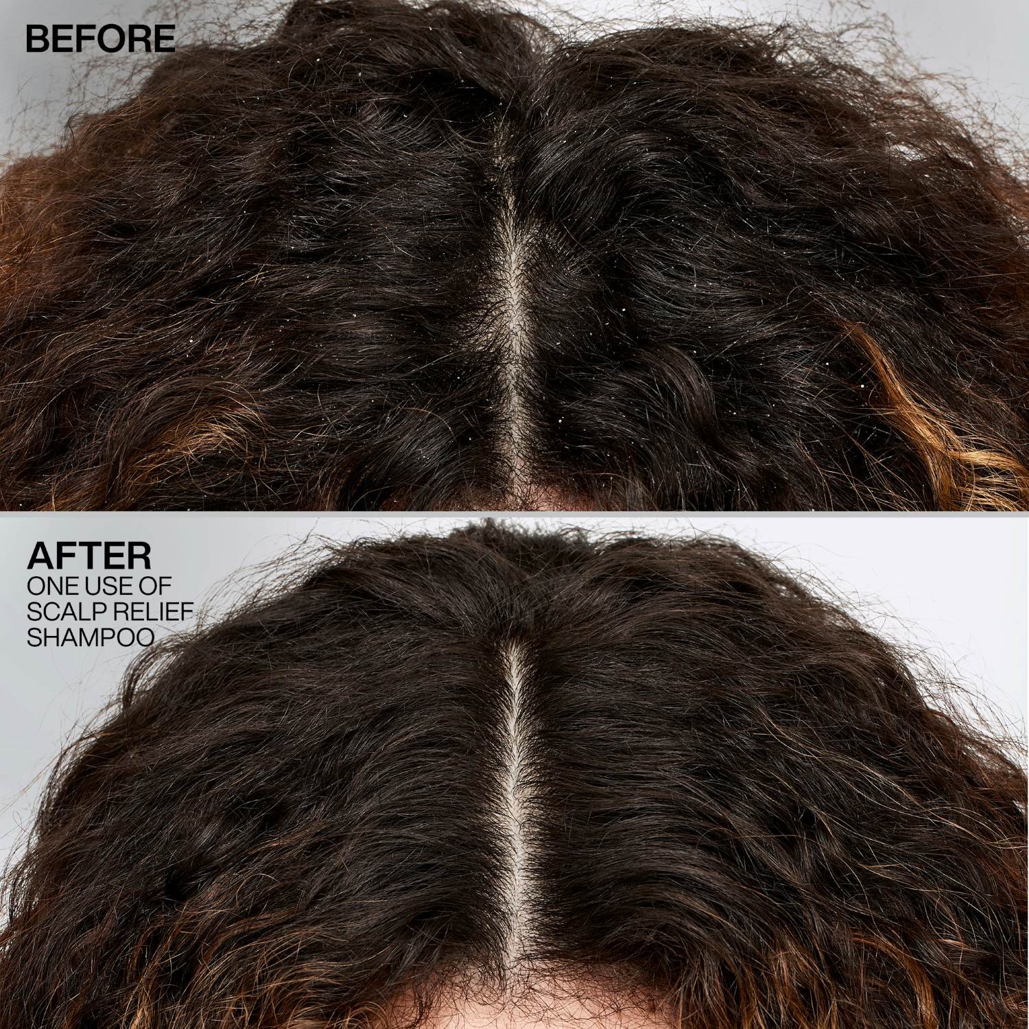 Scalp Relief Dandruff Control Shampoo Redkeniltä
